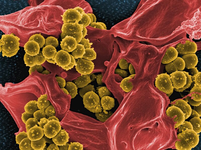Antimikrobiální rezistence – globální hrozba, která se týká každého